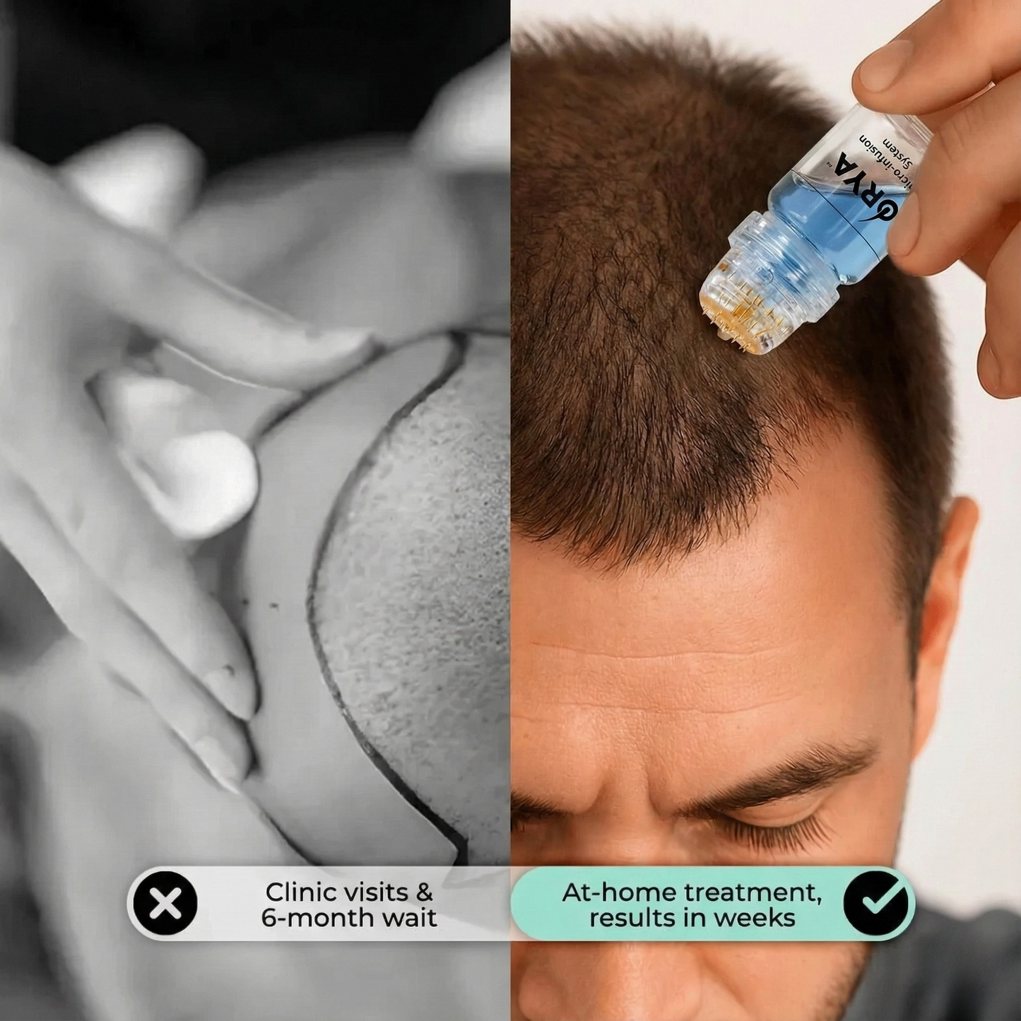 ORYA™ | Fast, Natural Boost for Hair Growth