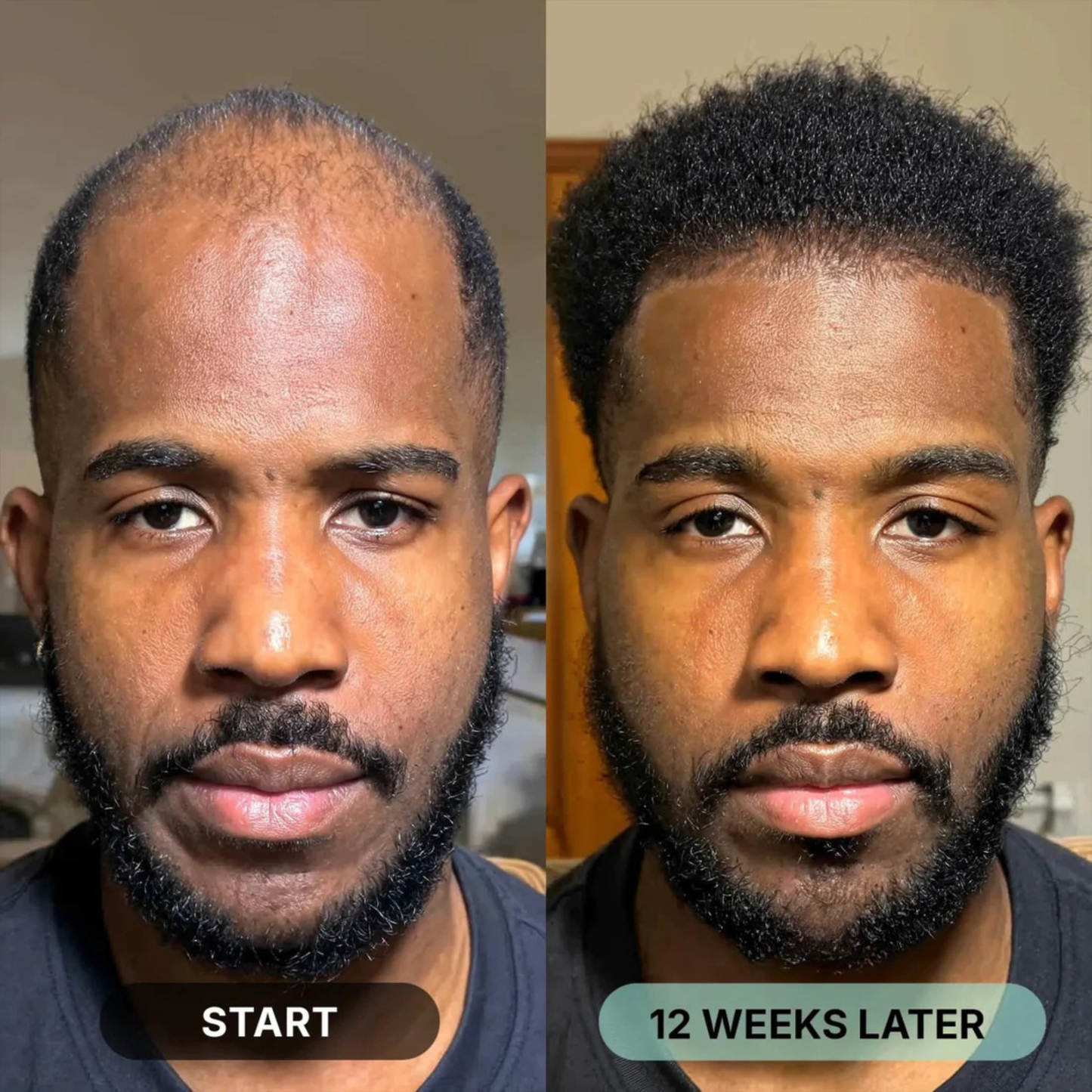 ORYA™ | Fast, Natural Boost for Hair Growth