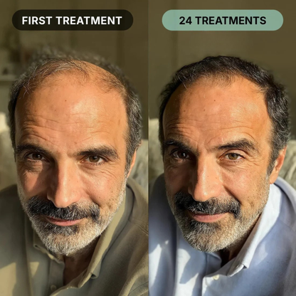 ORYA™ | Fast, Natural Boost for Hair Growth