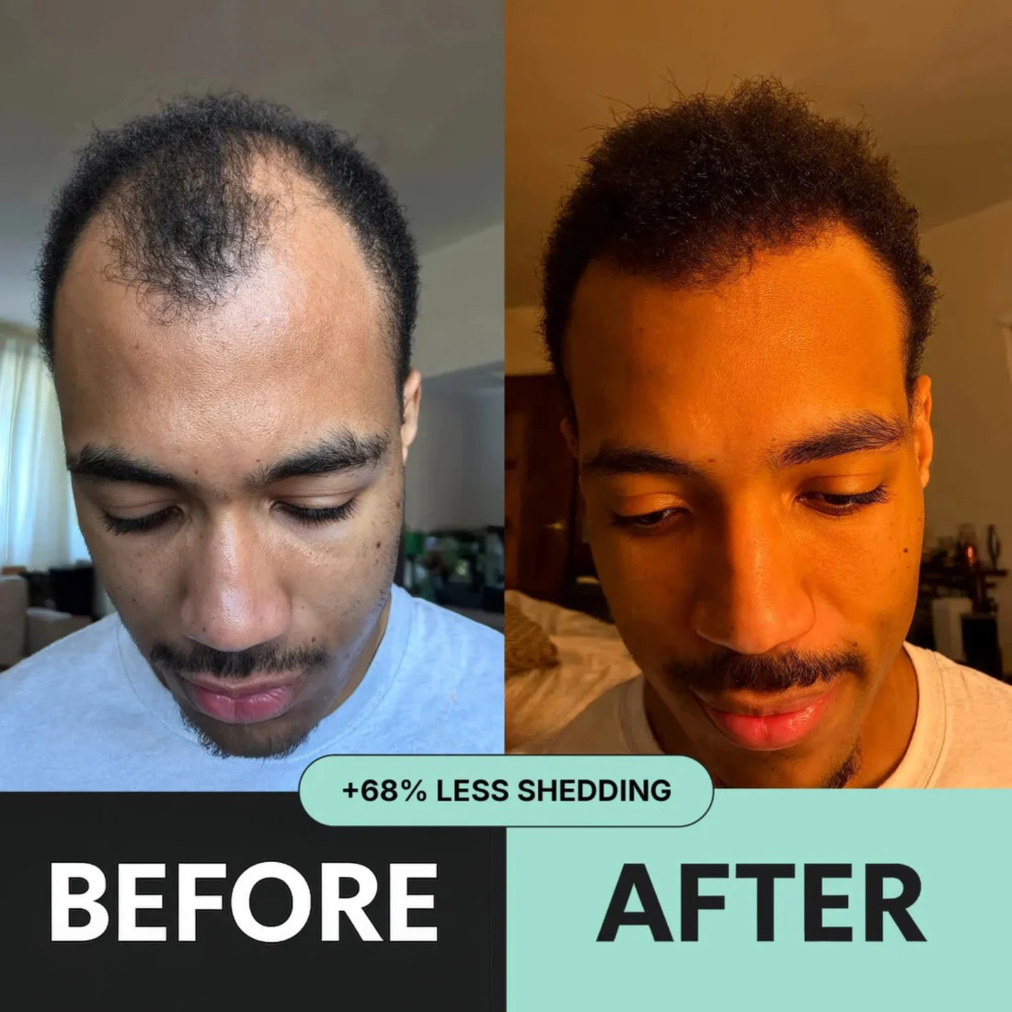 ORYA™ | Fast, Natural Boost for Hair Growth