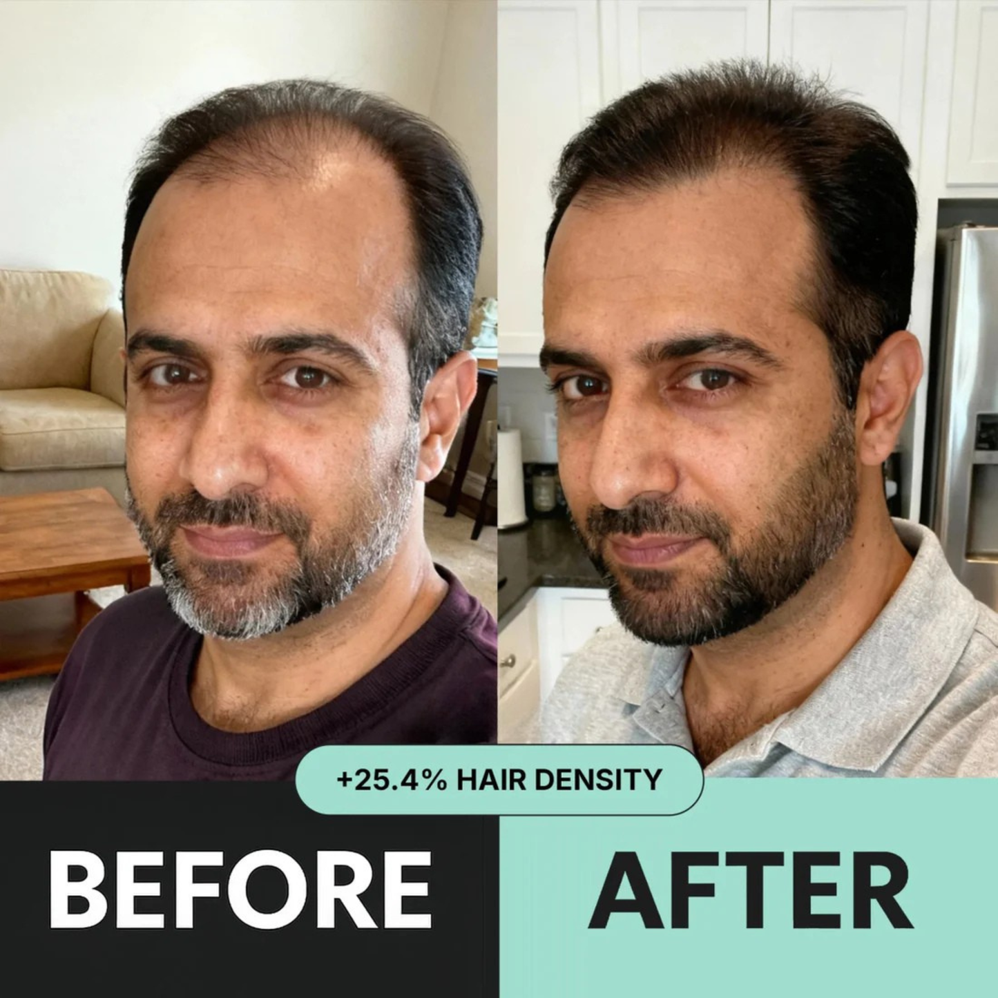 ORYA™ | Fast, Natural Boost for Hair Growth