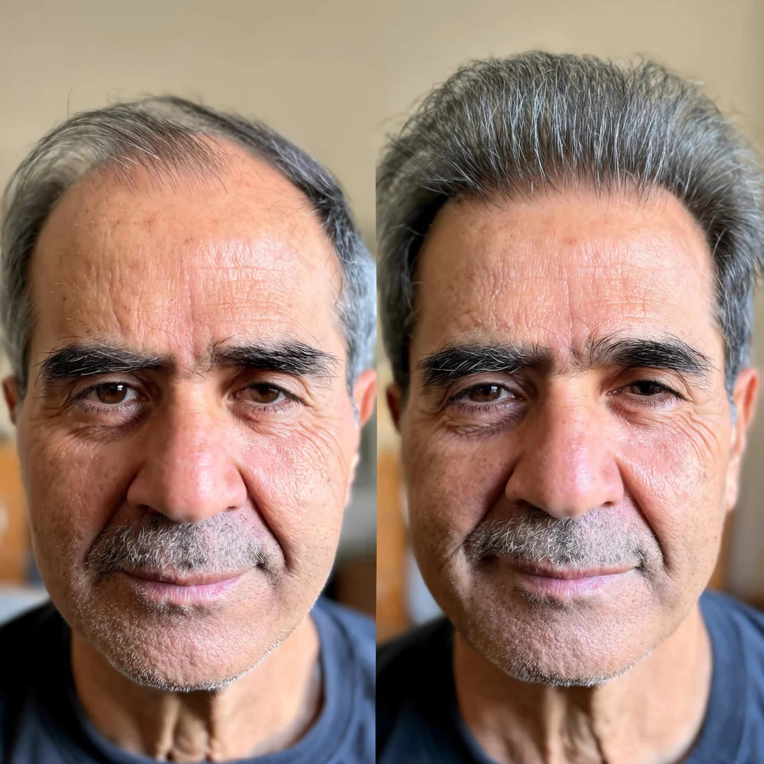 ORYA™ | Fast, Natural Boost for Hair Growth